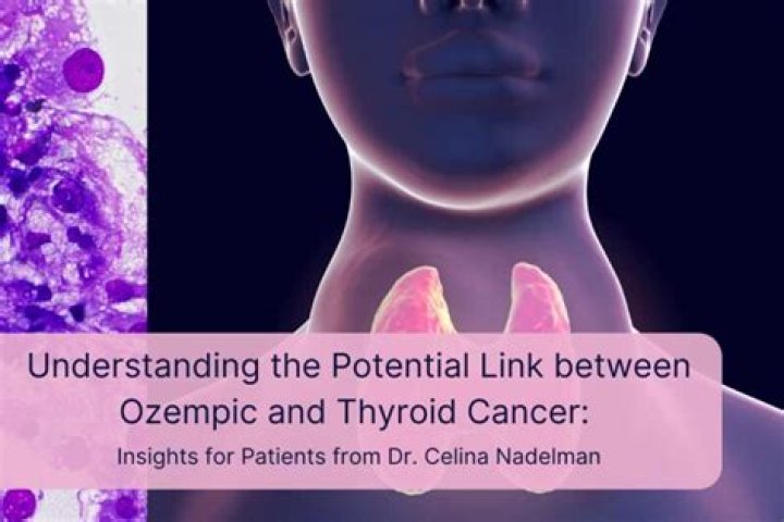 Can Ozempic Cause Thyroid Cancer? Dibesity