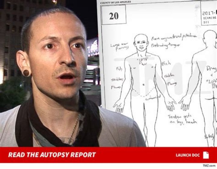 Chester Bennington Autopsy Report Released