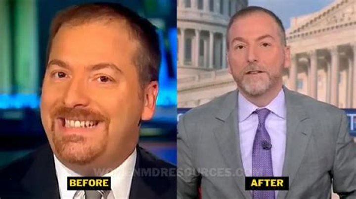 Chuck Todd Illness Weight Loss Before And After Photos