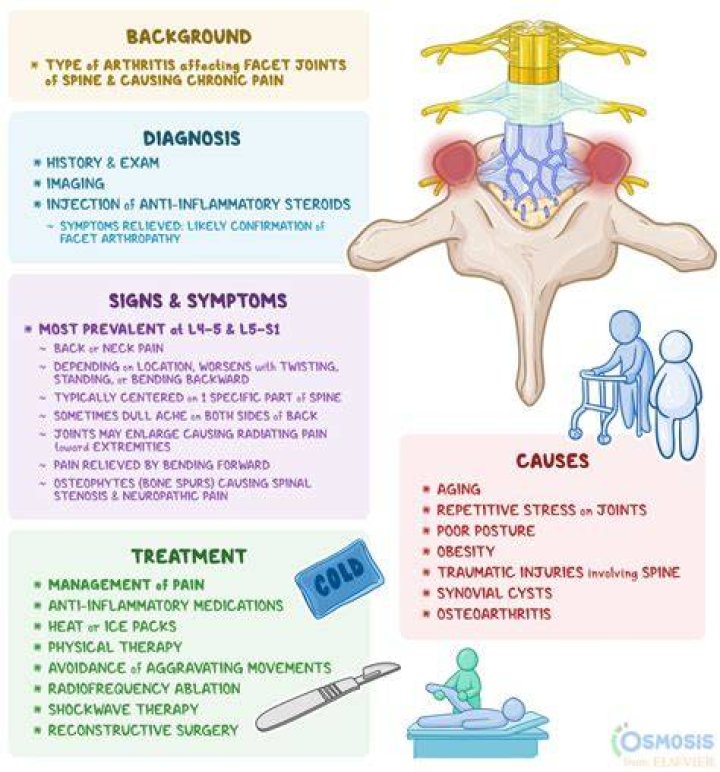 Facet Arthropathy Causes, Symptoms & Treatments