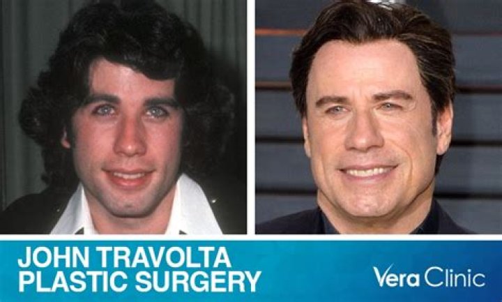 John Travolta Plastic Surgery The Fear Of Getting Old?