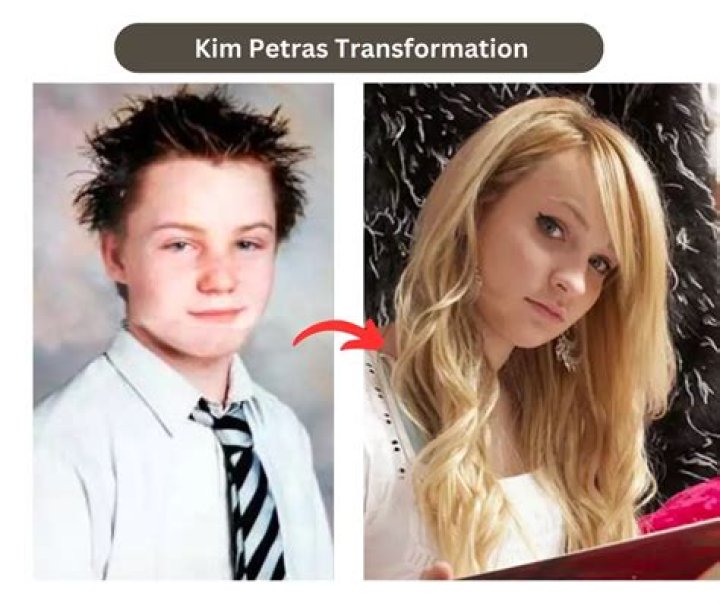 Kim Petras Before and After Transformation OtakuKart