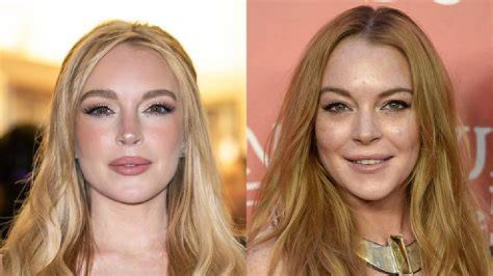 Lindsay Lohan Plastic Surgery An Improvement?