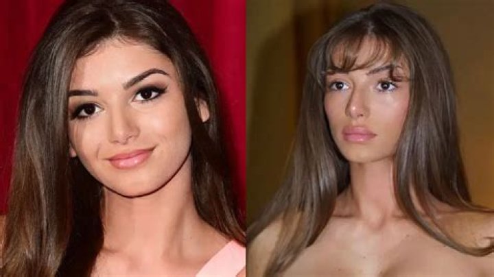 Mimi Keene parents, before surgery, ethnicity, and partner Tuko.co.ke