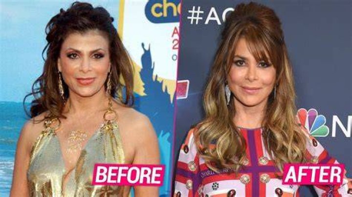 Paula Abdul Revealed Getting Plastic Surgery Before
