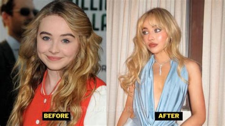 Sabrina Carpenter Before and After Looks, Current Weight, Surgery