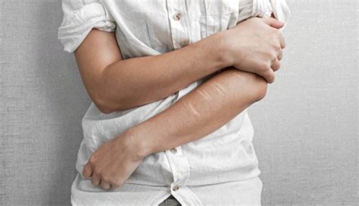 Selfharm isn't necessarily an attempt at suicide; it is a cry for help