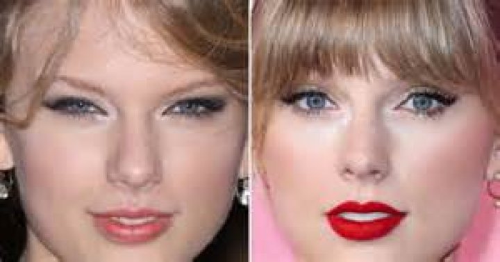Taylor Swift Plastic Surgery Mystery SOLVED!