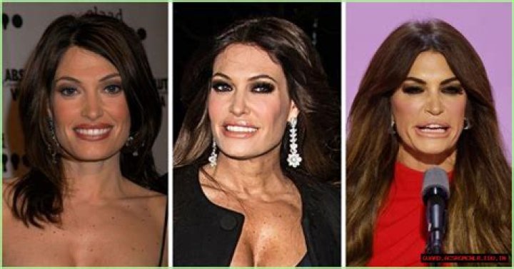 Unveiling The Secrets Behind Kimberly Guilfoyle's Face Work