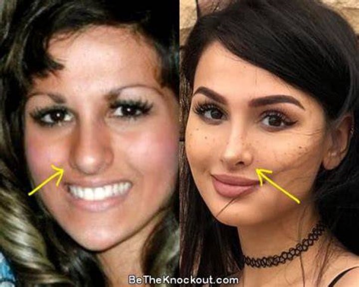 What Plastic Surgery Has SSSniperWolf Done? Plastic Surgery Celebs